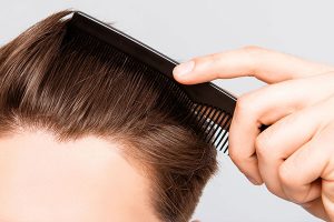 hair transplant turkey