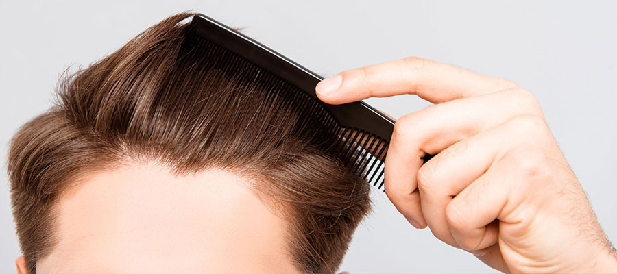 hair transplant turkey