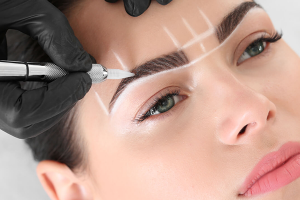 eyebrow transplantation